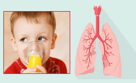 Phòng ngừa viêm đường hô hấp ở trẻ và giải pháp từ Subavax